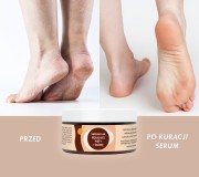 serum na piety i pękającą skórę